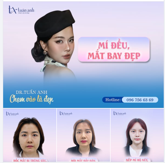 MẮT XINH THẦN THÁI CHỈ SAU MỘT LẦN "CHẠM"