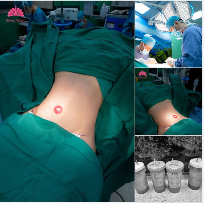 BODY ĐỒNG HỒ CÁT - EO THON GỌN, RẠNG RỠ ĐÓN TẾT