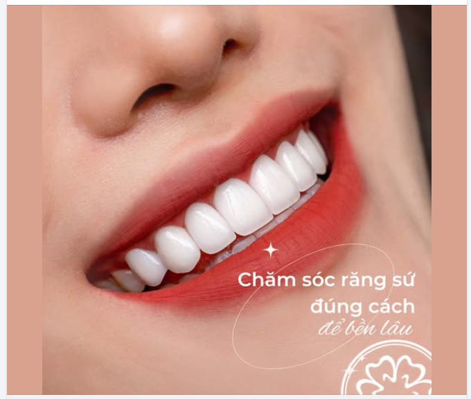 Làm được bộ răng sứ đẹp, nhưng bạn đã biết chăm sóc đúng cách để VỪA BỀN VỪA ĐẸP chưa?
