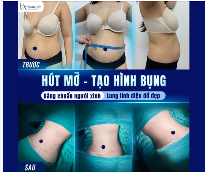 EO THON THÔI LÀ CHƯA ĐỦ? EO THON NHƯNG PHẢI "VÀO DÁNG" CHUẨN MỚI LÀ CHÂN ÁI!