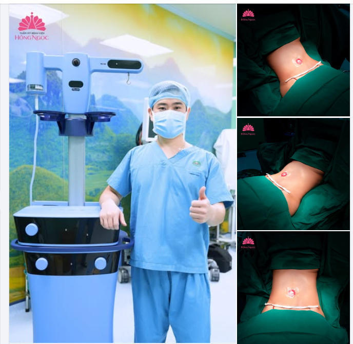 MỠ DÀY, EO TO - NỖI LO KÉO DÀI?  ĐÃ CÓ VASER LIPO – “GIẢI PHÁP VÀNG” CHO VÓC DÁNG THON GỌN!