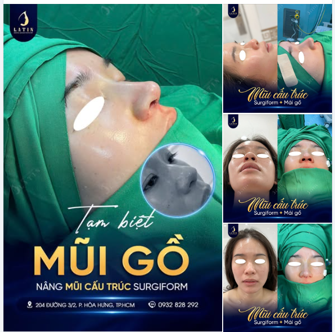 MỘT ĐƯỜNG SỐNG, HAI ĐOẠN GÃY - TẤT CẢ ĐỀU TẠI ĐIỂM GỒ