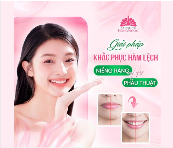 Giải mã nguyên nhân “Mặt lệch” - Niềng răng hay phẫu thuật mới là giải pháp đúng?