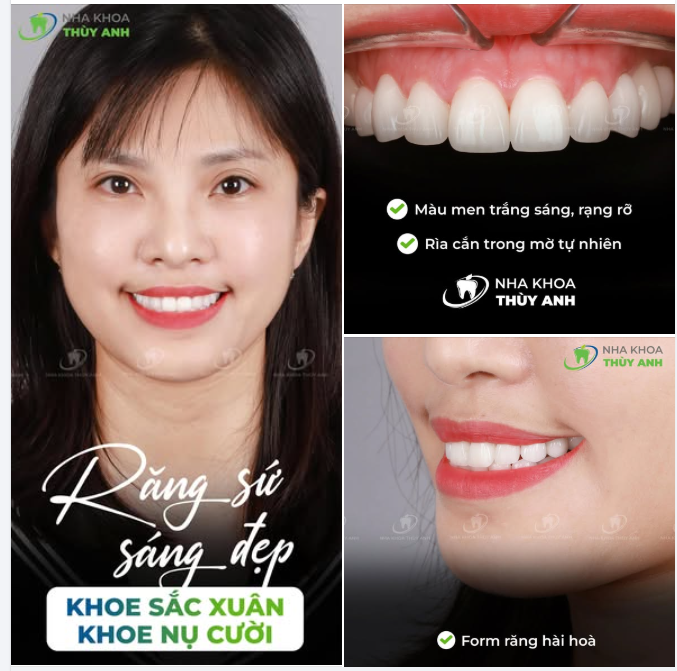 KHI NỤ CƯỜI TỰ TIN, SẮC ĐẸP CŨNG TỎA SÁNG THEO