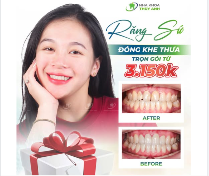 KHI MÙA LỄ HỘI ĐẾN GẦN - NỤ CƯỜI ĐẸP TRỞ THÀNH "PHỤ KIỆN" KHÔNG THỂ THIẾU
