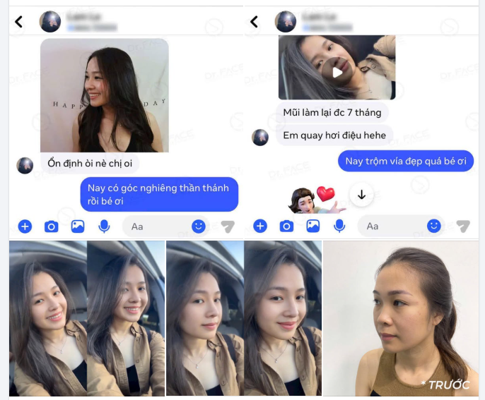 KHI GÓC NGHIÊNG BIẾT NÓI