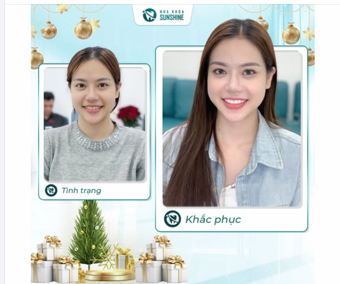 “Chị muốn làm răng để kịp đi chơi Noel, có được không em??”