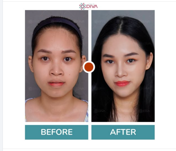 ĐIỀU GÌ TRÊN KHUÔN MẶT CỦA CÔ GÁI ĐƯỢC CẢI THIỆN RÕ RỆT NHẤT?