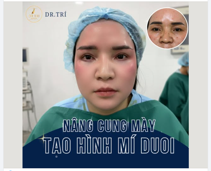 SỢ MẮT GIÀ – MUỐN CỬA SỔ TÂM HỒN TRẺ LẠI 10 TUỔI?