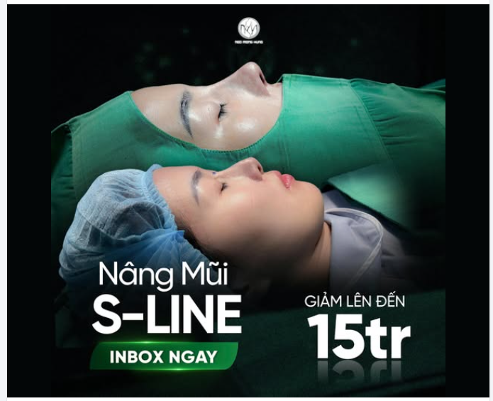 Vì sao nhiều KH lựa chọn nâng mũi cận Tết?