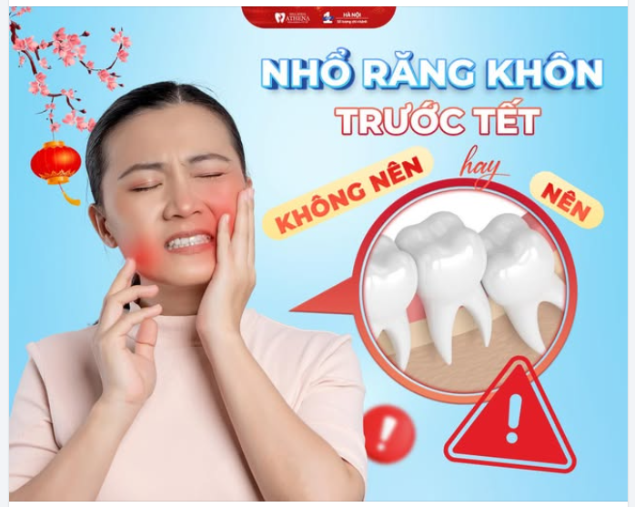 VÌ SAO BÁC SĨ KHUYÊN: NÊN NHỔ RĂNG KHÔN TRƯỚC TẾT?