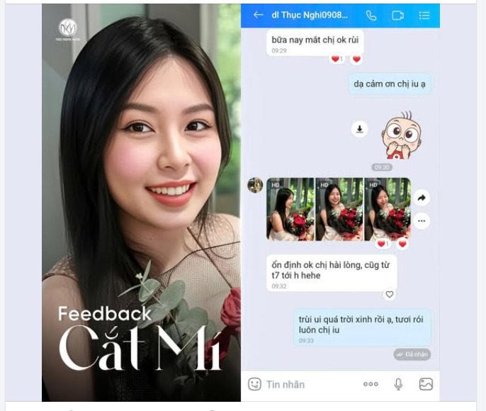 Trải nghiệm KH cắt mí sau 6 tháng.