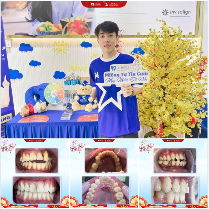 NGUYỄN THÀNH NAM: TẠM BIỆT TỰ TI, ĐÓN DIỆN MẠO MỚI CÙNG MẮC CÀI KIM LOẠI