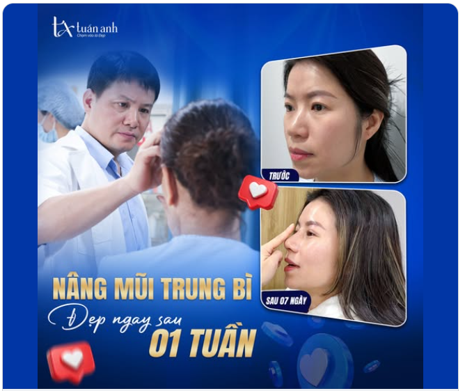 Tự tin hơn chỉ sau 07 ngày – khi chọn đúng bác sĩ và đúng phương pháp