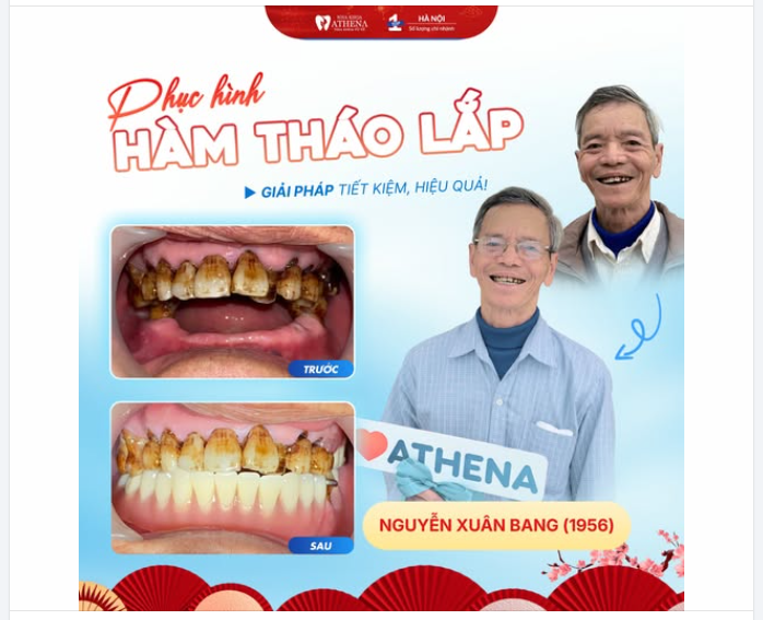 THÊM MỘT NỤ CƯỜI TRỌN VẸN TRƯỚC THỀM NĂM MỚI