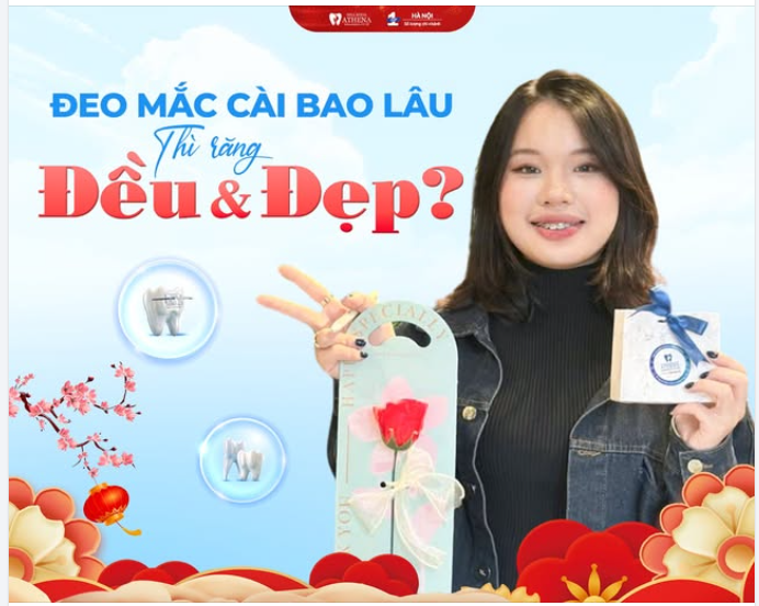 NIỀNG RĂNG BAO LÂU THÌ ĐỀU VÀ ĐẸP? BẬT MÍ 3 YẾU TỐ "TĂNG TỐC" THỜI GIAN NIỀNG RĂNG