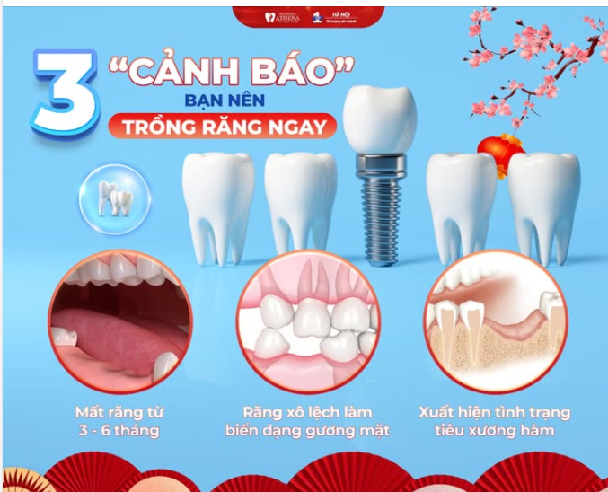 3 DẤU HIỆU "BÁO ĐỘNG ĐỎ" NHẮC BẠN PHẢI ĐI TRỒNG RĂNG NGAY LẬP TỨC