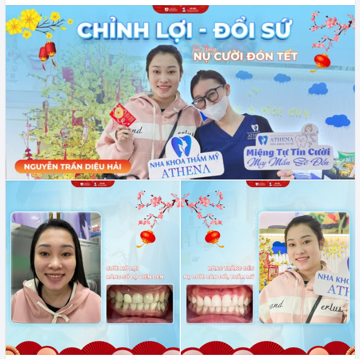 ĐỪNG ĐỂ RĂNG SỨ LỖI LÀM MẤT ĐI SỰ TỰ TIN ĐÓN TẾT!