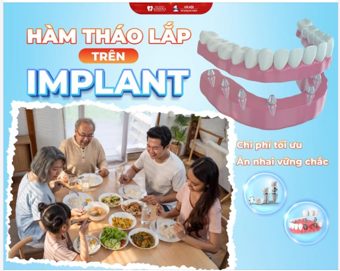 HÀM THÁO LẮP TRÊN IMPLANT: ĂN NHAI VỮNG CHÃI – CHI PHÍ TỐI ƯU