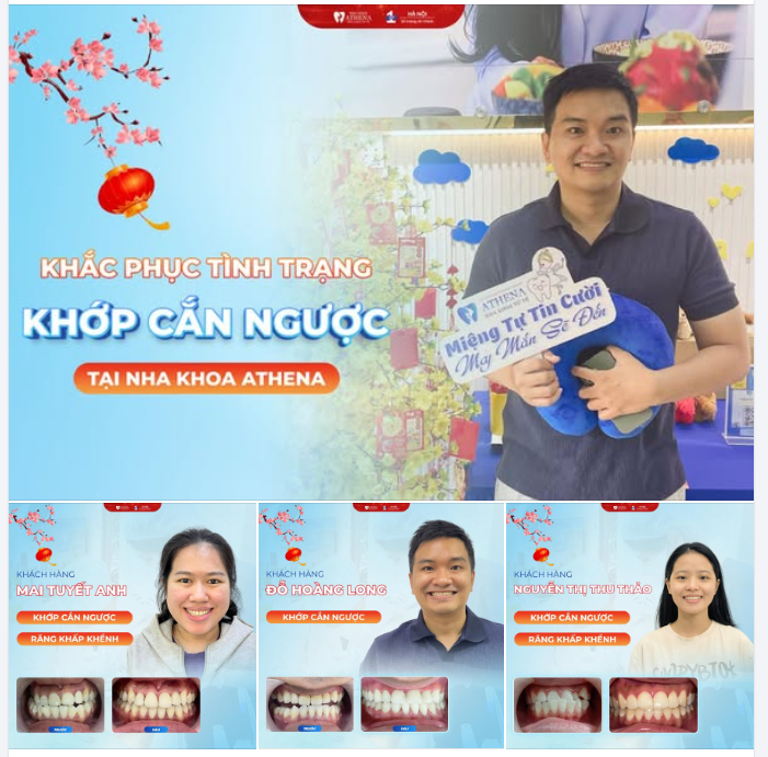 KHẮC PHỤC KHỚP CẮN NGƯỢC: KHÔNG CHỈ LÀ THẨM MỸ, ĐÓ LÀ SỨC KHỎE!