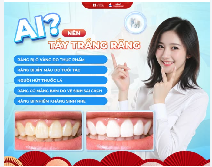 NHỮNG AI NÊN (VÀ RẤT NÊN) TẨY TRẮNG RĂNG