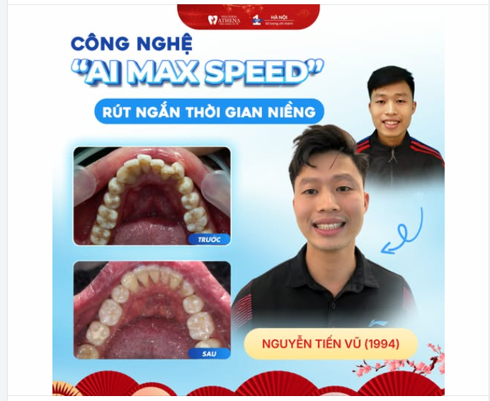NIỀNG RĂNG KHÔNG CHỈ LÀ LÀM ĐỀU  HÀNH TRÌNH THAY ĐỔI THẦN THÁI TÌM LẠI TỰ TIN