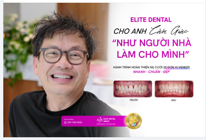 HOÀN THIỆN THẨM MỸ TOÀN HÀM VỚI 20 VENEERS - KHÉP LẠI KẼ THƯA, MỞ RA NỤ CƯỜI THOẢI MÁI
