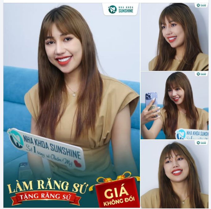 LÀM RĂNG SỨ – TẶNG RĂNG SỨ  GIÁ KHÔNG ĐỔI – KHÔNG PHÁT SINH