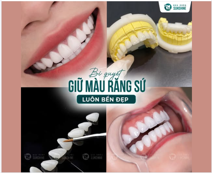 Điều nhiều người lo nhất sau khi bọc răng sứ là gì?