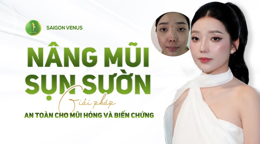 NÂNG MŨI SỤN SƯỜN - GIẢI PHÁP AN TOÀN CHO MŨI HỎNG VÀ MŨI BIẾN CHỨNG