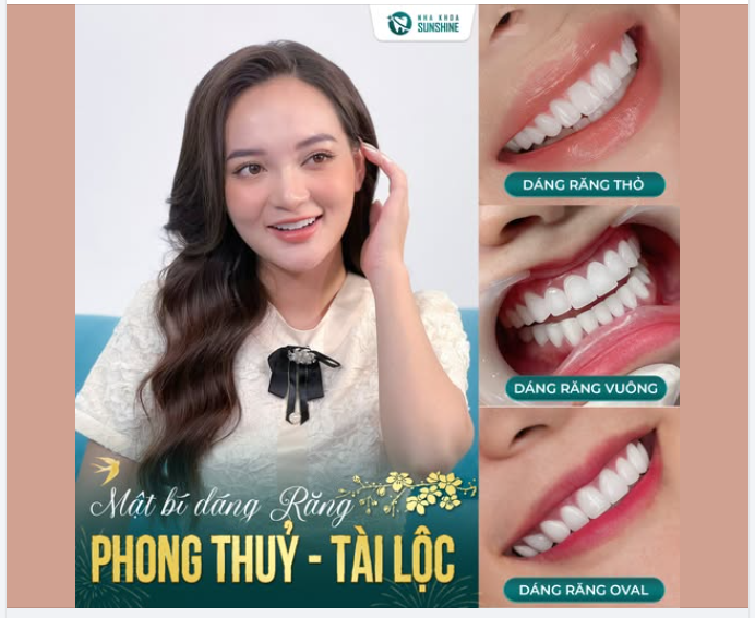 BẬT MÍ 3 DÁNG RĂNG – PHONG THUỶ TÀI LỘC