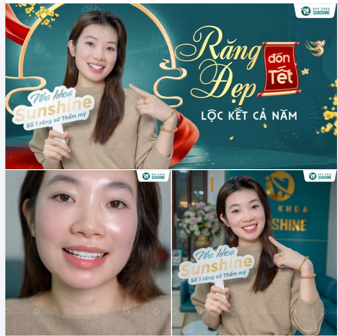 LÀM RĂNG SỨ - ĐỔI NỤ CƯỜI, MỞ TÀI LỘC