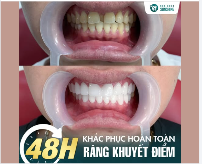 Tết đến gần rồi, ai cũng muốn mình trông tươi tắn hơn một chút.