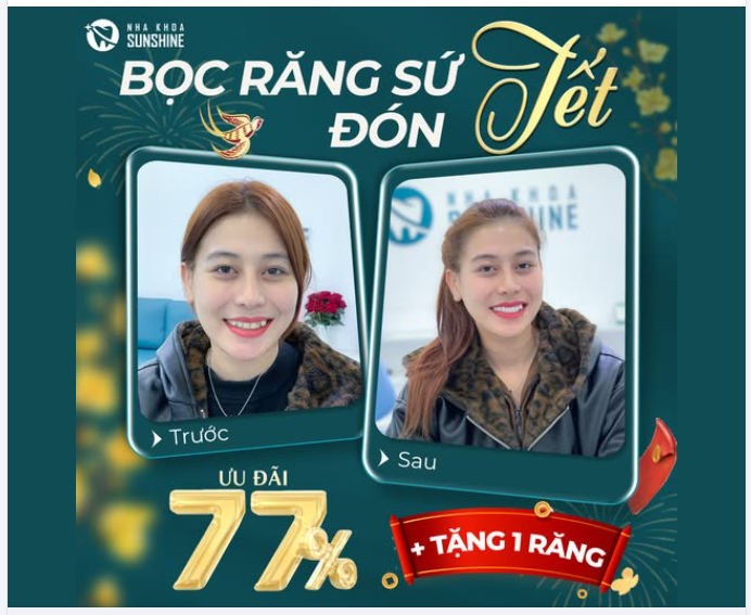 LÀM RĂNG ĐẸP ĐÓN TẾT SANG - ƯU ĐÃI LÊN ĐẾN 77% + TẶNG 1 RĂNG KHI LÀM COMBO 16 RĂNG HT SMILE