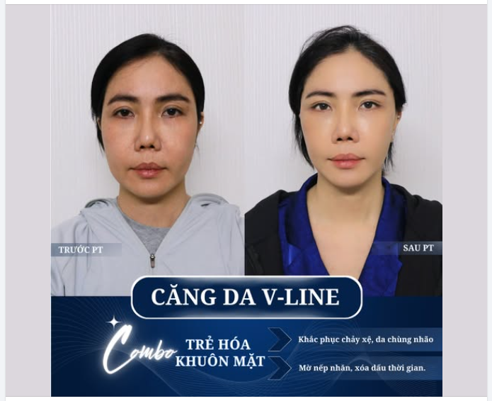 SỢ GIÀ NUA – MUỐN TRẺ LẠI: "CHÌA KHÓA" HỒI XUÂN LÀ ĐÂY!
