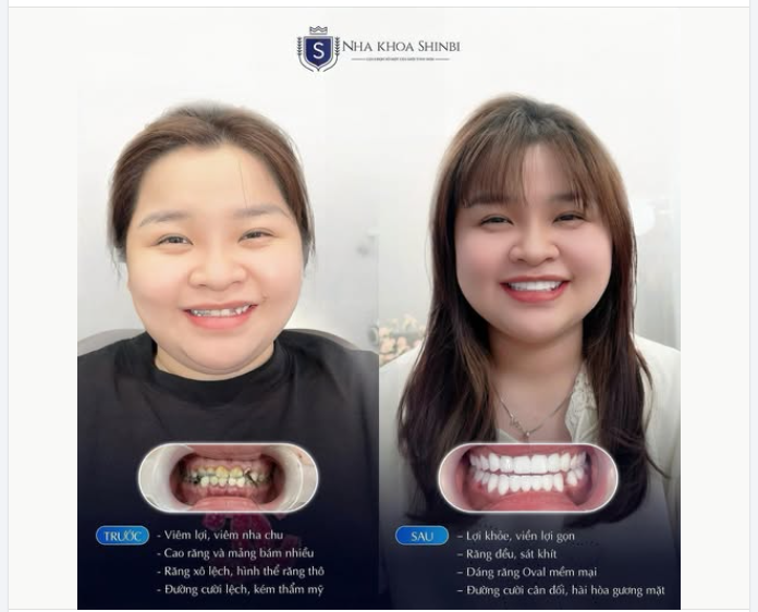 PHÉP MÀU CHO NỤ CƯỜI HẠNH PHÚC – TỰ TIN TỎA SÁNG SAU 72H
