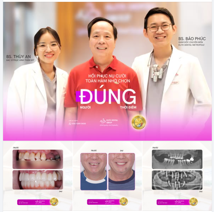 HỒI PHỤC NỤ CƯỜI TOÀN HÀM NHỜ CHỌN ĐÚNG NGƯỜI - ĐÚNG THỜI ĐIỂM
