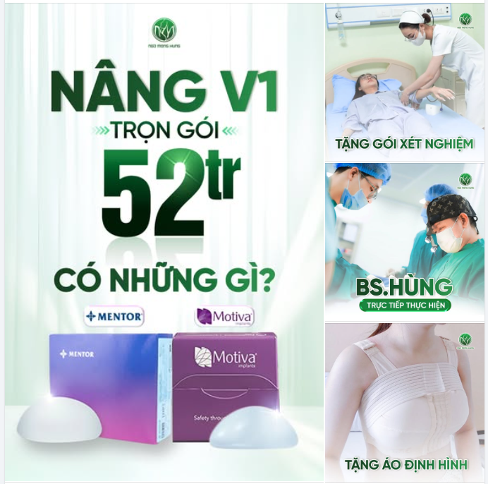 Nâng V1 trọn gói 52TR có những gì?