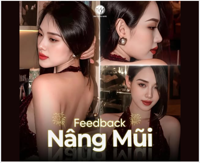 KỊP! Kịp nâng mũi đón Tết sang đấy ạ!