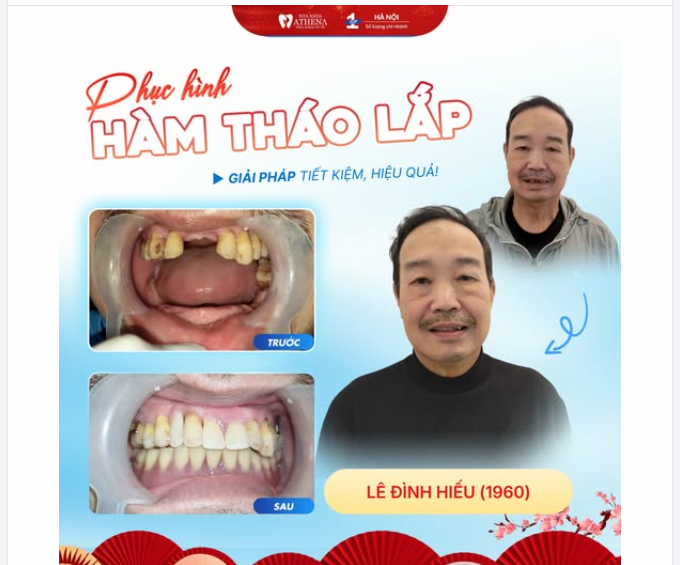 NỤ CƯỜI HÔM NAY THẬT ĐẶC BIỆT, TẾT NĂM NAY RẠNG RỠ HƠN NĂM NGOÁI!
