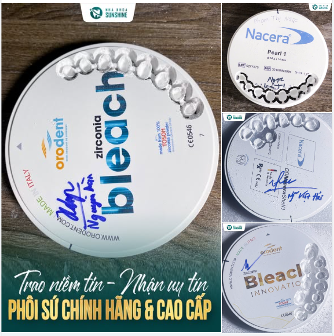 Cận Tết rồi… bạn còn đang phân vân làm răng sứ?