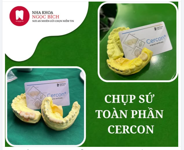 RĂNG SỨ CERCON - SỰ LỰA CHỌN LÝ TƯỞNG TRONG THẨM MỸ RĂNG SỨ