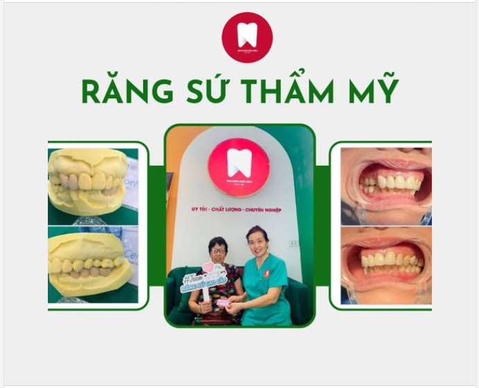 AN TÂM THIẾT KẾ NỤ CƯỜI VỚI RĂNG SỨ CHÍNH HÃNG 100%