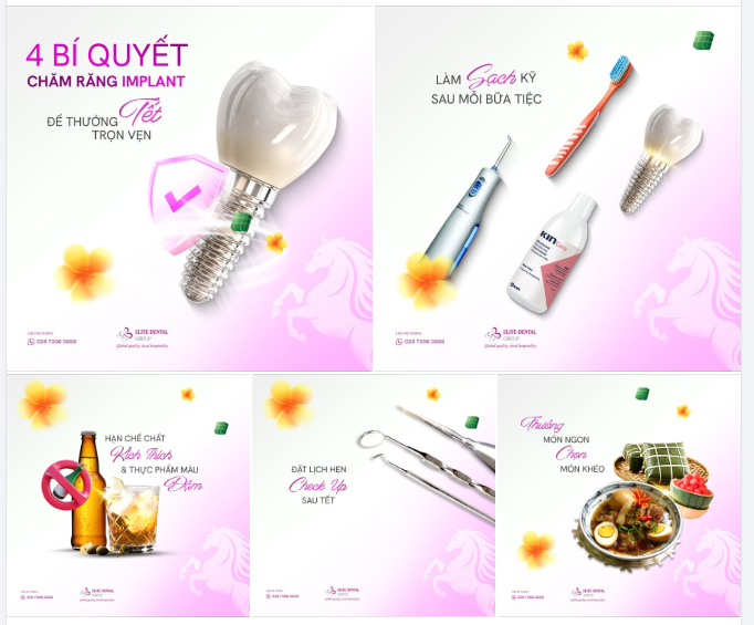 BỎ TÚI 4 BÍ QUYẾT CHĂM RĂNG IMPLANT ĐỂ THƯỞNG TẾT TRỌN VẸN