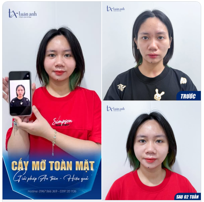 SAU KHI ĐƯỢC MẸ ĐƯA ĐI LÀM ĐẸP – KẾT QUẢ KHIẾN AI CŨNG BẤT NGỜ