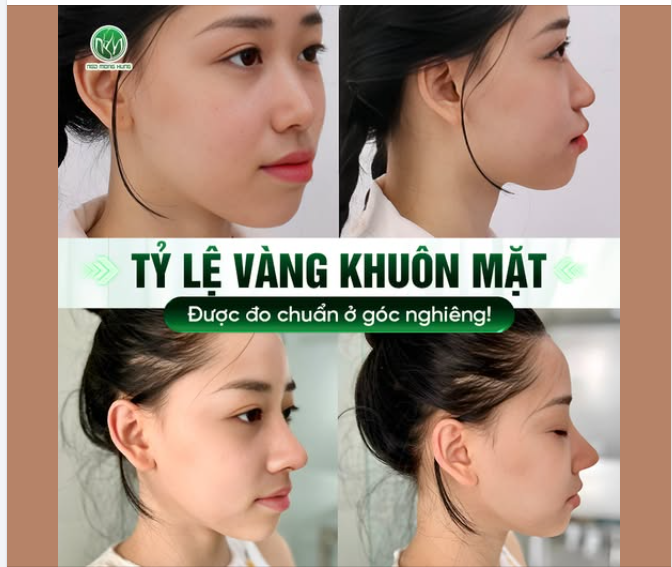 Tỷ lệ vàng khuôn mặt khi nhìn nghiêng được chuẩn hóa dựa trên?