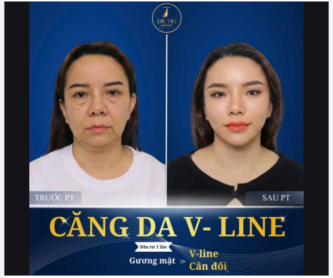 LẤY LẠI 10 NĂM TUỔI XUÂN – CHỈ SAU 1 LIỆU TRÌNH
