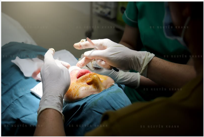 DÁNG CẰM V-LINE: CHUẨN TỈ LỆ VÀNG, ĐẸP MỌI GÓC NHÌN