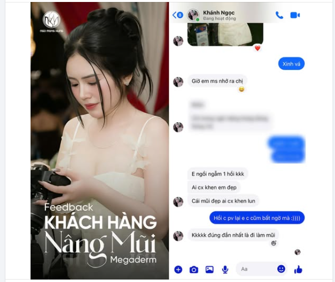 "Em ngồi ngẫm 1 hồi. Ai cũng khen em đẹp. Đúng đắn nhất là đi làm mũi" - KH chia sẻ sau khi thực hiện Nâng Mũi