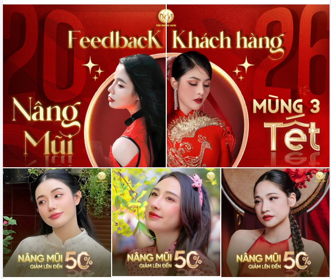 FEEDBACK NÂNG MŨI – MÙNG 3 TẾT